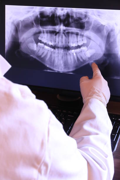 Best Emergency Dentist for Lost Fillings or Crowns in Benton Harbor, MI