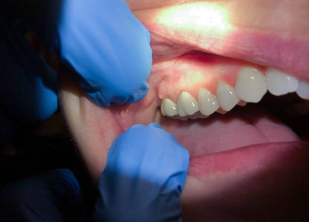 Best Mobile Emergency Dentist in Benton Harbor, MI