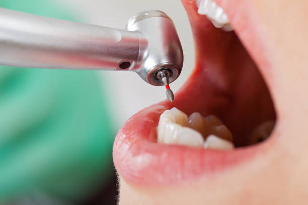 Best Emergency Dentist for Lost Fillings or Crowns in Benton Harbor, MI